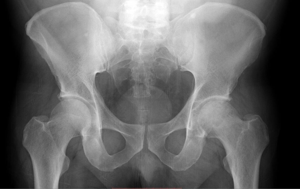 diagnostica dell'articolazione dell'anca