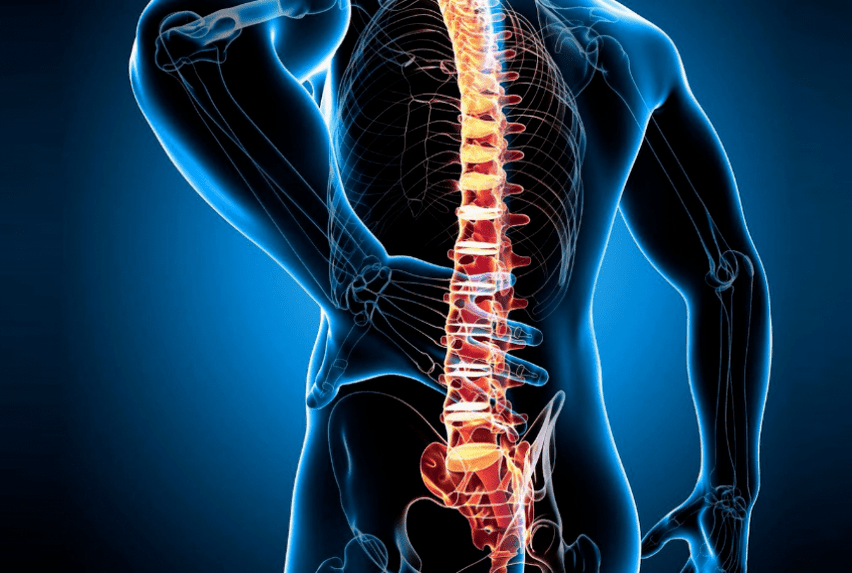 osteocondrosi