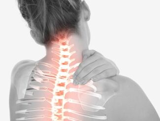 Osteocondrosi della regione cervicale