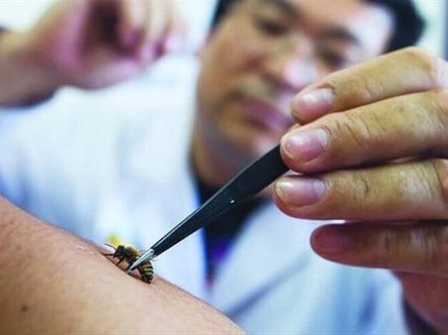 Apiterapia per l'osteocondrosi cervicale