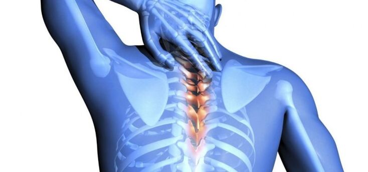 danno alla colonna vertebrale come causa di dolore tra le scapole